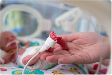 عوارض جبران ناپذیر تولد لاکچری برای سلامت مادر و نوزاد